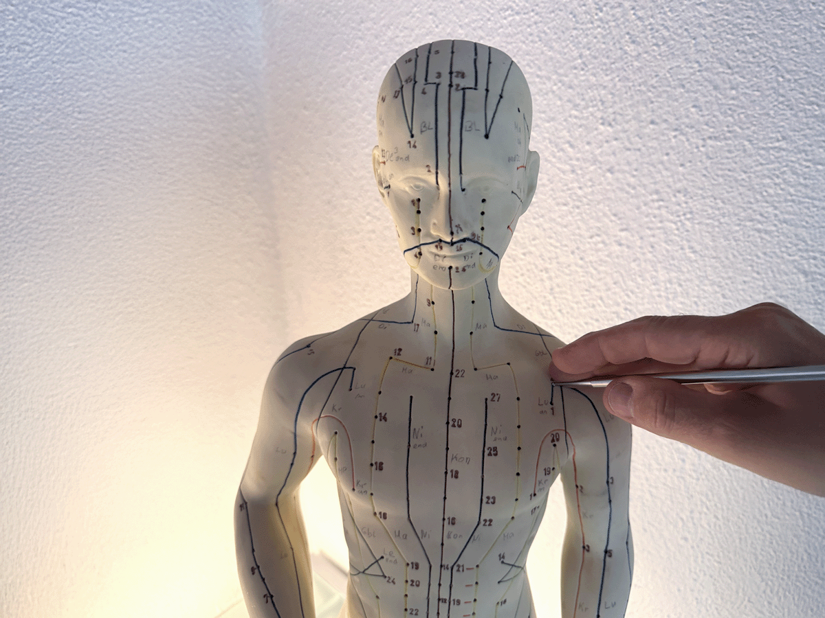 Anwendungsgebiet akupunkturpunkte modell 1